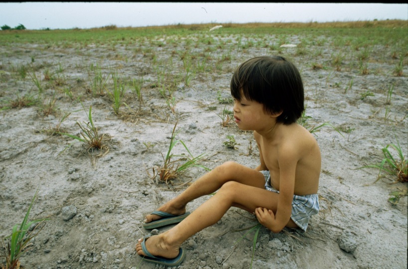 Vietnamesisches Kind mit verkrüppelten Armen (1989)